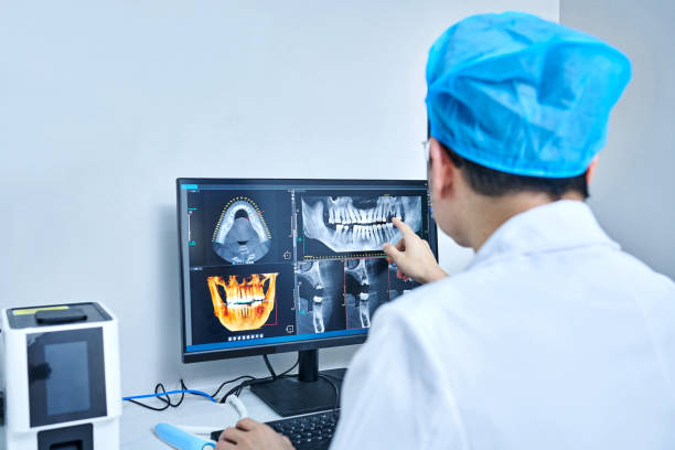 Best Emergency Wisdom Tooth Extraction in Antwerp, OH